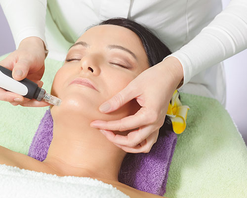 micro needling treatments